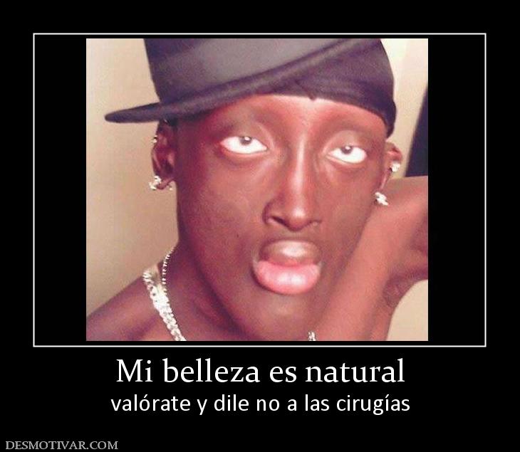 Mi belleza es natural valórate y dile no a las cirugías