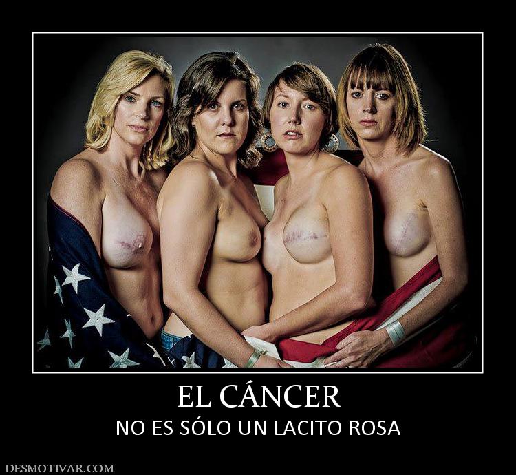 EL CÁNCER NO ES SÓLO UN LACITO ROSA