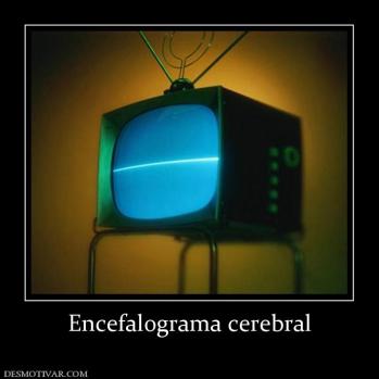 Encefalograma cerebral