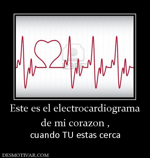 Este es el electrocardiograma de mi corazon , cuando TU estas cerca